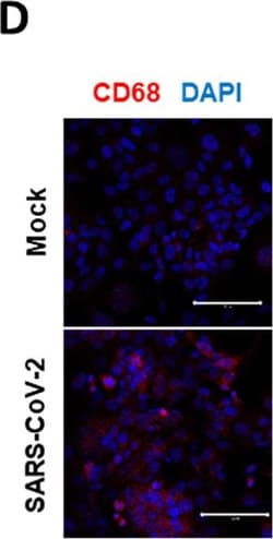 Invitrogen Donkey anti-Mouse IgG (H+L) Highly Cross-Adsorbed Secondary