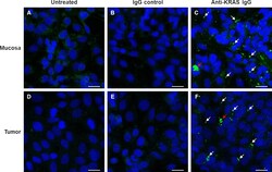 Invitrogen&trade;&nbsp;Goat anti-Rabbit IgG (H+L) Cross-Adsorbed Secondary Antibody, FITC