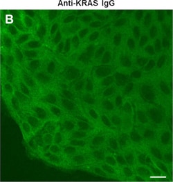 Invitrogen&trade;&nbsp;Goat anti-Rabbit IgG (H+L) Cross-Adsorbed Secondary Antibody, FITC