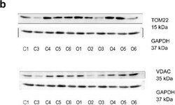 Invitrogen Goat anti-Mouse IgG (H+L) Secondary Antibody, DyLight 488 1