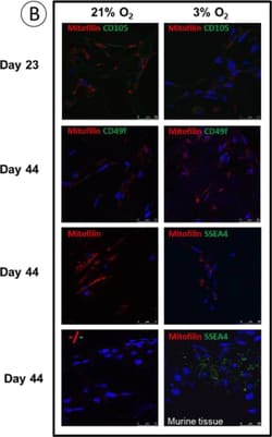 Invitrogen Goat anti-Mouse IgG (H+L) Cross-Adsorbed Secondary Antibody,
