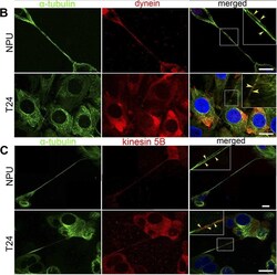Invitrogen Goat anti-Mouse IgG (H+L) Cross-Adsorbed Secondary Antibody,