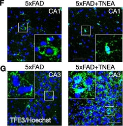 Invitrogen Goat anti-Rabbit IgG (H+L) Cross-Adsorbed Secondary Antibody,