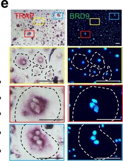 Invitrogen Goat anti-Rabbit IgG (H+L) Cross-Adsorbed Secondary Antibody,