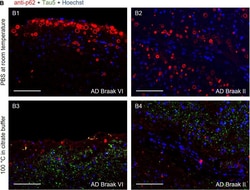 Invitrogen&trade;&nbsp;Goat anti-Mouse IgG2a Cross-Adsorbed Secondary Antibody, Alexa Fluor&trade; 555