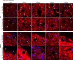 Invitrogen&trade;&nbsp;Goat anti-Mouse IgG2a Cross-Adsorbed Secondary Antibody, Alexa Fluor&trade; 555