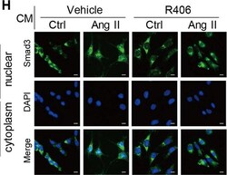 Invitrogen Goat anti-Mouse IgG (H+L) Cross-Adsorbed Secondary Antibody,
