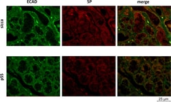 Invitrogen Donkey anti-Mouse IgG (H+L) Highly Cross-Adsorbed Secondary