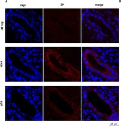 Invitrogen Donkey anti-Mouse IgG (H+L) Highly Cross-Adsorbed Secondary