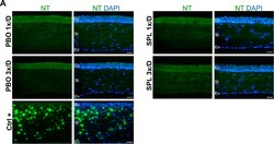 Invitrogen Goat anti-Rabbit IgG (H+L) Cross-Adsorbed Secondary Antibody,