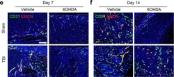 Invitrogen Donkey anti-Rat IgG (H+L) Secondary Antibody, TRITC 1 mg; TRITC:Antibodies,