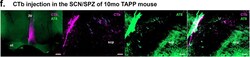 Invitrogen F(ab')2-Donkey anti-Mouse IgG (H+L) Highly Cross-Adsorbed Secondary