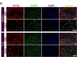 Invitrogen Goat anti-Rabbit IgG (H+L) Cross-Adsorbed Secondary Antibody,