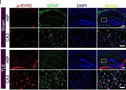 Invitrogen Goat anti-Rabbit IgG (H+L) Cross-Adsorbed Secondary Antibody,