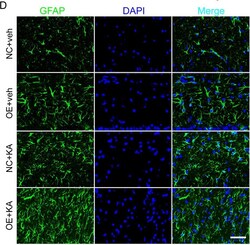 Invitrogen Goat anti-Rabbit IgG (H+L) Cross-Adsorbed Secondary Antibody,