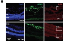 Invitrogen Goat anti-Mouse IgG (H+L) Cross-Adsorbed Secondary Antibody,