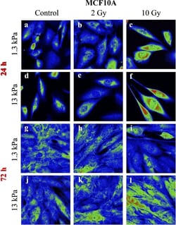 Invitrogen Goat anti-Rabbit IgG (H+L) Cross-Adsorbed Secondary Antibody,
