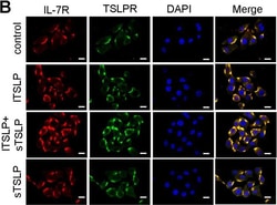 Invitrogen&trade;&nbsp;Donkey anti-Rabbit IgG (H+L) ReadyProbes&trade; Secondary Antibody, Alexa Fluor&trade; 594