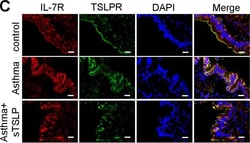 Invitrogen&trade;&nbsp;Donkey anti-Rabbit IgG (H+L) ReadyProbes&trade; Secondary Antibody, Alexa Fluor&trade; 594