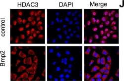 Invitrogen&trade;&nbsp;Donkey anti-Rabbit IgG (H+L) ReadyProbes&trade; Secondary Antibody, Alexa Fluor&trade; 594