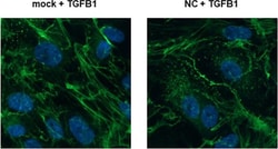 Invitrogen Goat anti-Rabbit IgG (H+L) Cross-Adsorbed Secondary Antibody,
