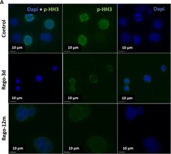 Invitrogen Goat anti-Rabbit IgG (H+L) Secondary Antibody, DyLight 488 1