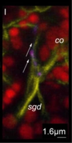 Invitrogen Goat anti-Rabbit IgG (H+L) Cross-Adsorbed Secondary Antibody,