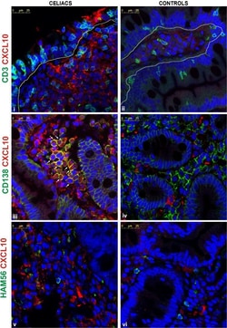 Invitrogen™ F(ab')2-Goat anti-Rabbit IgG (H+L) Cross-Adsorbed Secondary Antibody, Alexa Fluor™ 647