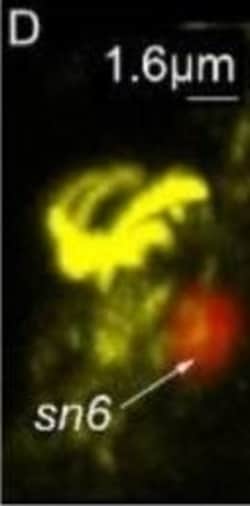 Invitrogen Goat anti-Rabbit IgG (H+L) Cross-Adsorbed Secondary Antibody,