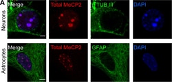 Invitrogen Goat anti-Rabbit IgG (H+L) Highly Cross-Adsorbed Secondary Antibody,