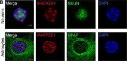 Invitrogen Goat anti-Rabbit IgG (H+L) Highly Cross-Adsorbed Secondary Antibody,