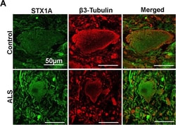 Invitrogen Donkey anti-Rabbit IgG (H+L) Highly Cross-Adsorbed Secondary