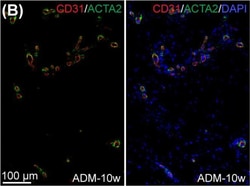 Invitrogen Donkey anti-Rabbit IgG (H+L) Highly Cross-Adsorbed Secondary