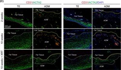 Invitrogen Donkey anti-Rabbit IgG (H+L) Highly Cross-Adsorbed Secondary