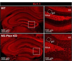 Invitrogen&trade;&nbsp;Goat anti-Mouse IgG2b Cross-Adsorbed Secondary Antibody, Alexa Fluor&trade; 594