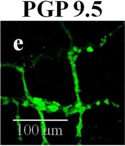 Invitrogen Donkey anti-Mouse IgG (H+L) Highly Cross-Adsorbed Secondary