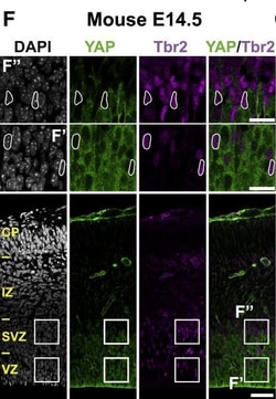 Invitrogen Donkey anti-Rabbit IgG (H+L) ReadyProbes Secondary Antibody,