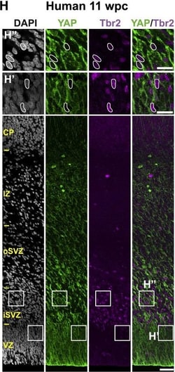 Invitrogen Donkey anti-Rabbit IgG (H+L) ReadyProbes Secondary Antibody,