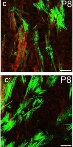 Invitrogen Donkey anti-Rat IgG (H+L) Highly Cross-Adsorbed Secondary Antibody,
