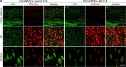 Invitrogen Donkey anti-Rabbit IgG (H+L) Highly Cross-Adsorbed Secondary