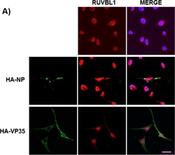 Invitrogen Goat anti-Mouse IgG (H+L) Highly Cross-Adsorbed Secondary Antibody,