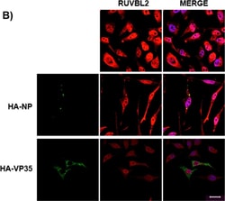Invitrogen Goat anti-Mouse IgG (H+L) Highly Cross-Adsorbed Secondary Antibody,