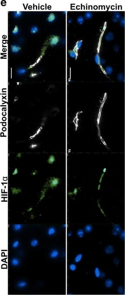 Invitrogen Donkey anti-Rabbit IgG (H+L) Cross-Adsorbed Secondary Antibody,