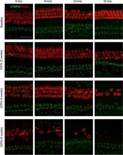 Invitrogen Goat anti-Rabbit IgG (H+L) Cross-Adsorbed Secondary Antibody,