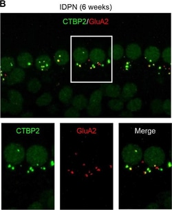 Invitrogen Goat anti-Mouse IgG1 Cross-Adsorbed Secondary Antibody, Alexa