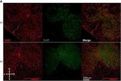 Invitrogen Goat anti-Rabbit IgG (H+L) Highly Cross-Adsorbed Secondary Antibody,