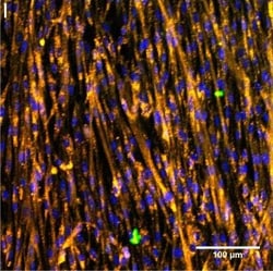Invitrogen Goat anti-Rabbit IgG (H+L) Cross-Adsorbed Secondary Antibody,
