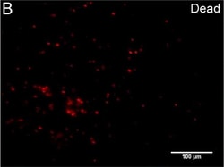 Invitrogen Goat anti-Rabbit IgG (H+L) Cross-Adsorbed Secondary Antibody,