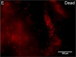 Invitrogen Goat anti-Rabbit IgG (H+L) Cross-Adsorbed Secondary Antibody,