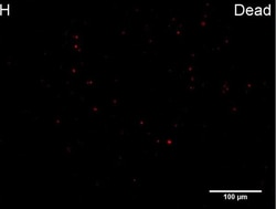 Invitrogen Goat anti-Rabbit IgG (H+L) Cross-Adsorbed Secondary Antibody,